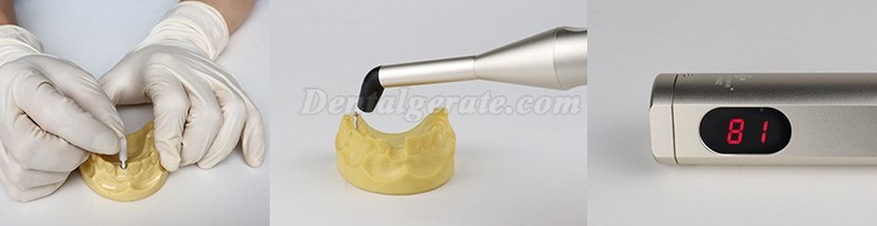 WJ Implant Stability Quotient Messger&auml;t Implant Stability-Messger&auml;t (Upgraded)
